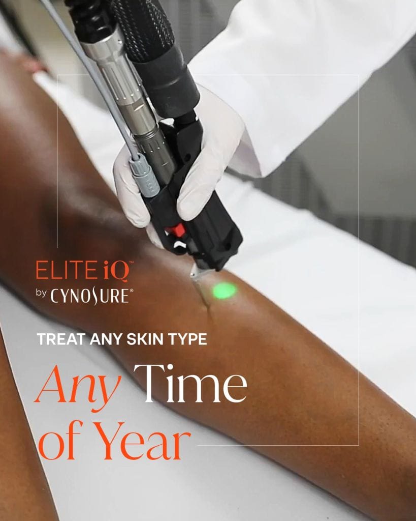 Full leg Elite iQ Laser Hair Removal Treatment on Dark Skin in Eastern Ontario, Canada