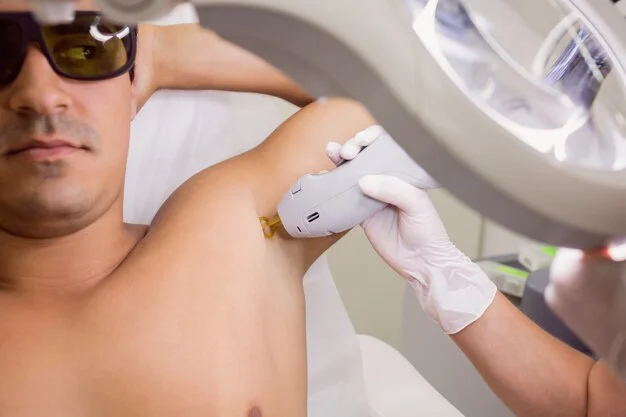 doctor performing laser hair removal male patient skin