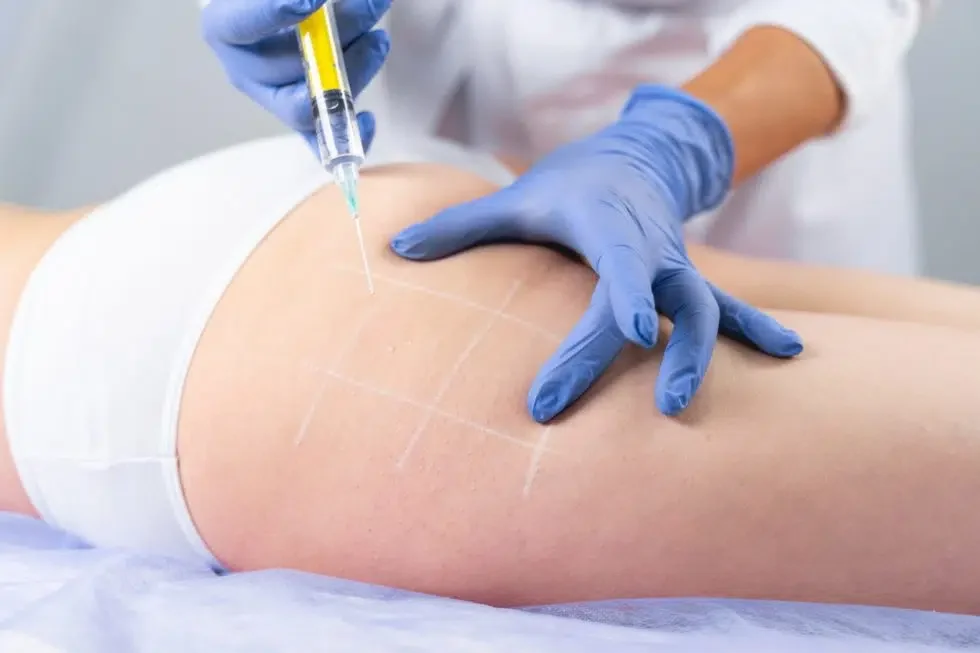 skin scaled for fat dissolving injections