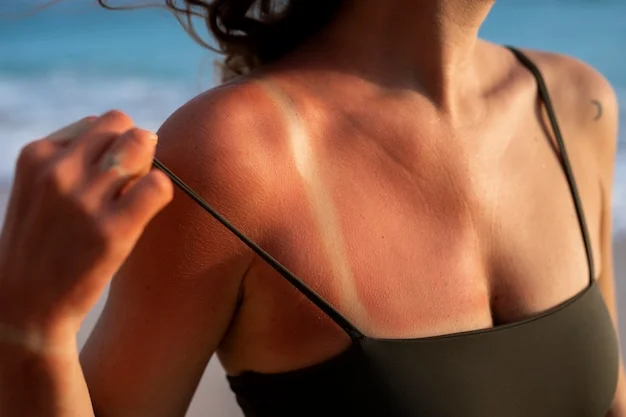 peau brûlée par le soleil d'une femme à la plage