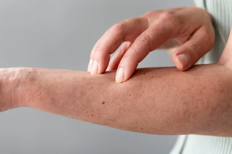 skin allergy persons arm