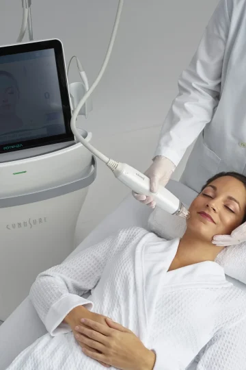 Potenza RF Microneedling Procedure_ landscape view (1)
