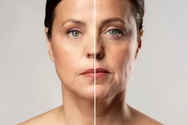 middle-aged-woman-before-and-after-photos-of-wrinkled-skin